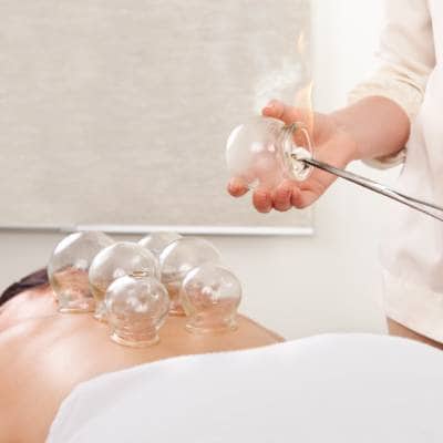 CUPPING